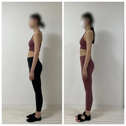 30代・女性のお客様の姿勢変化