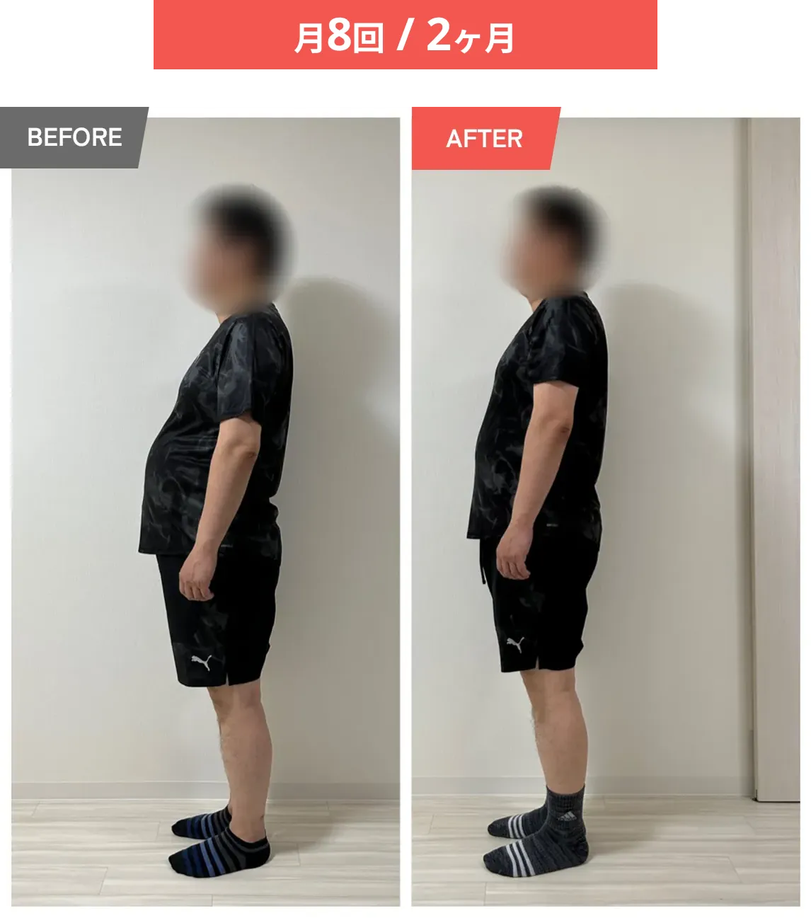 Studio I'llの男性の事例（Before/After）